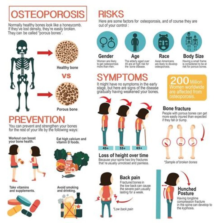 What is severe osteoporosis