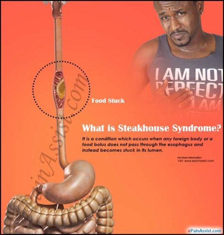 What is steakhouse syndrome