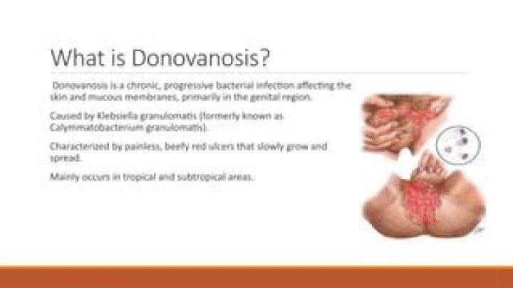 What is the cause of Donovanosis