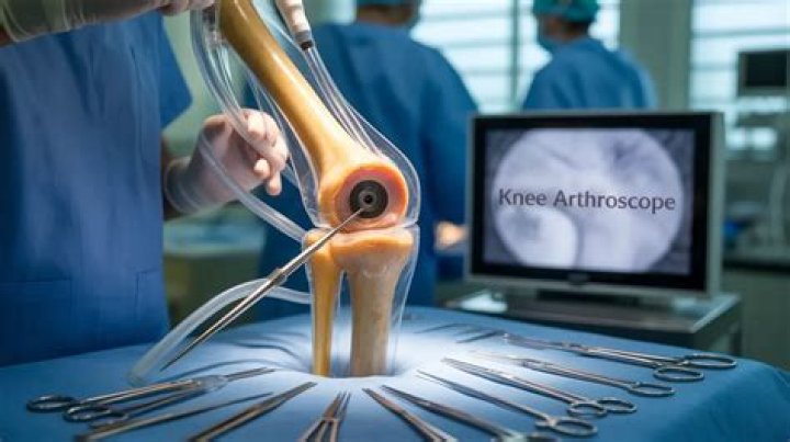 What is the CPT code for arthroscopy knee