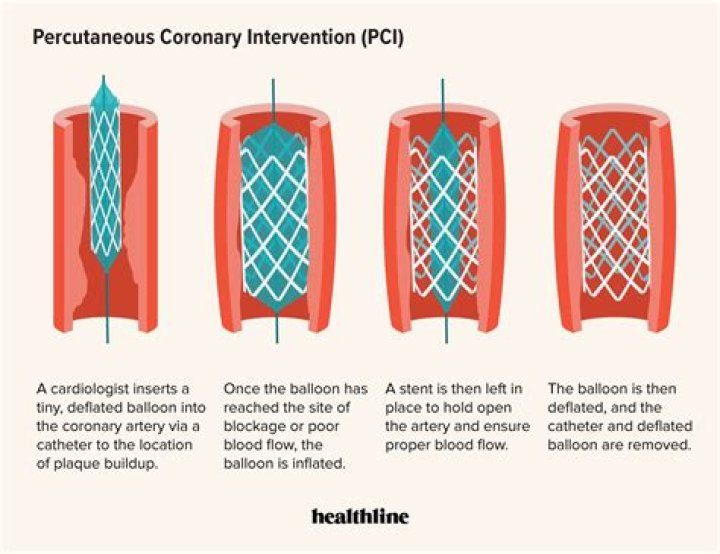 What is the difference between percutaneous and percutaneous endoscopic approaches