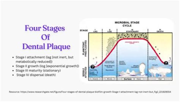 What is the first stage of plaque formation