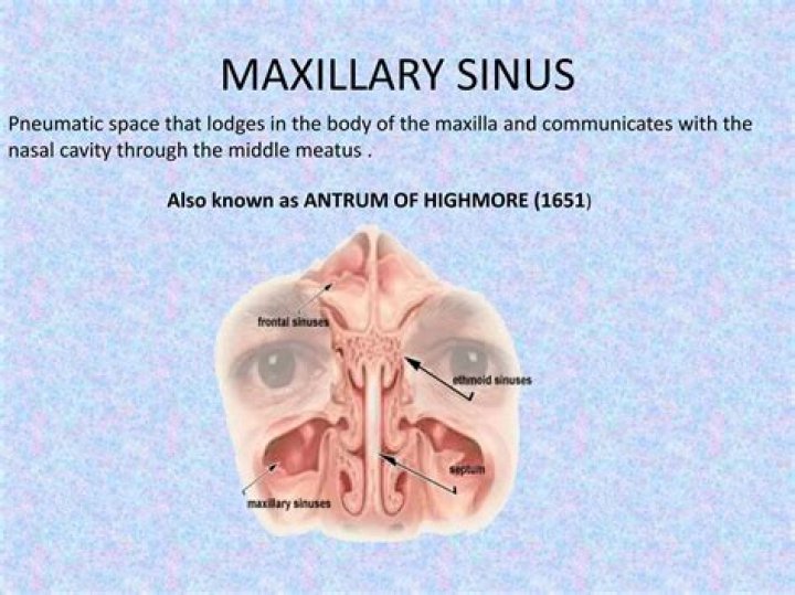 What is the maxillary sinus
