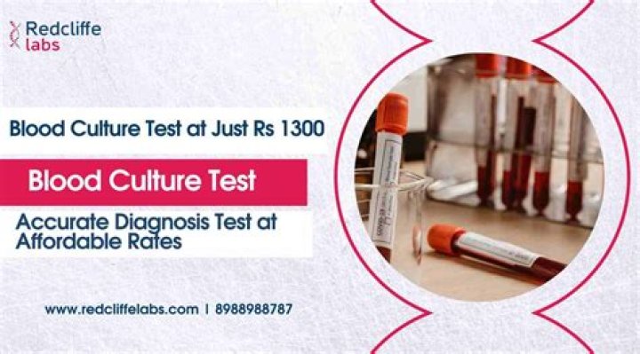 What is the purpose of a septic tank riser