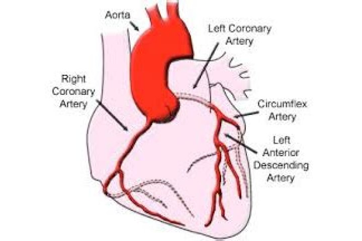 What is the Widowmaker artery