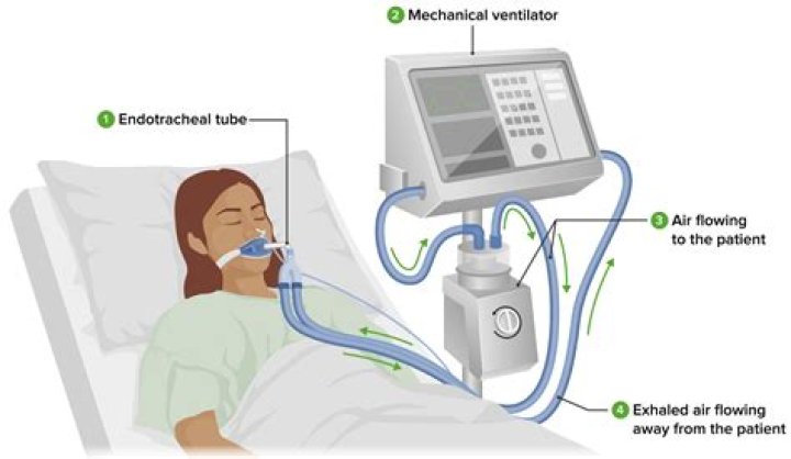 What is weaning from mechanical ventilation