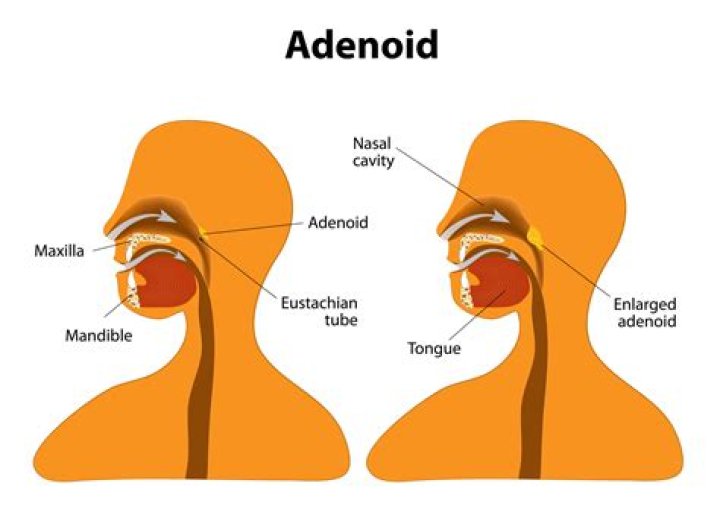 Where are the adenoids located