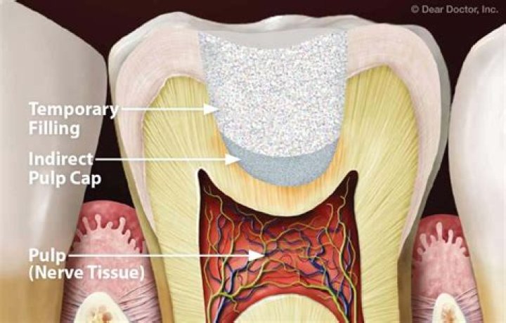 Where is the pulp in your tooth