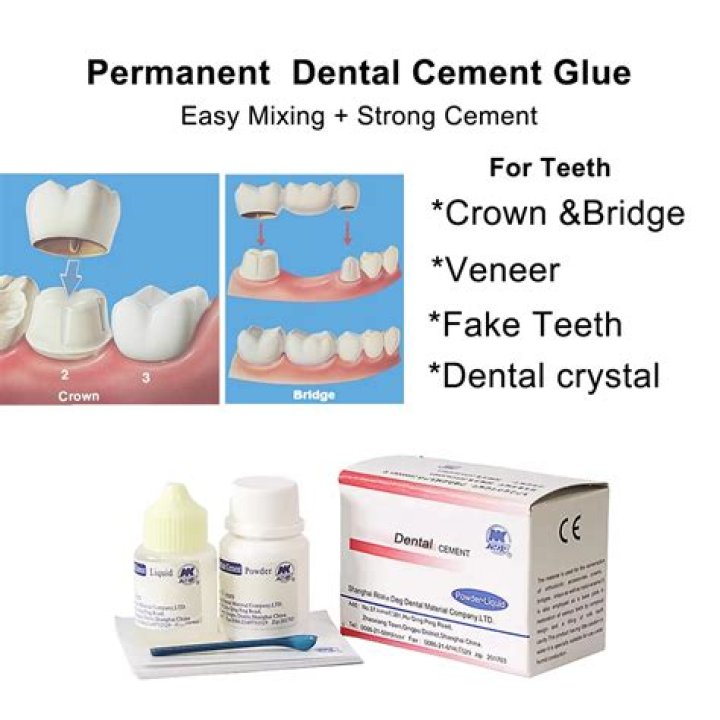 Where To Buy Dental Cement In Canada