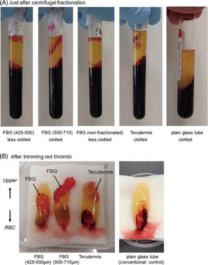 Which can degrade fibrin clot