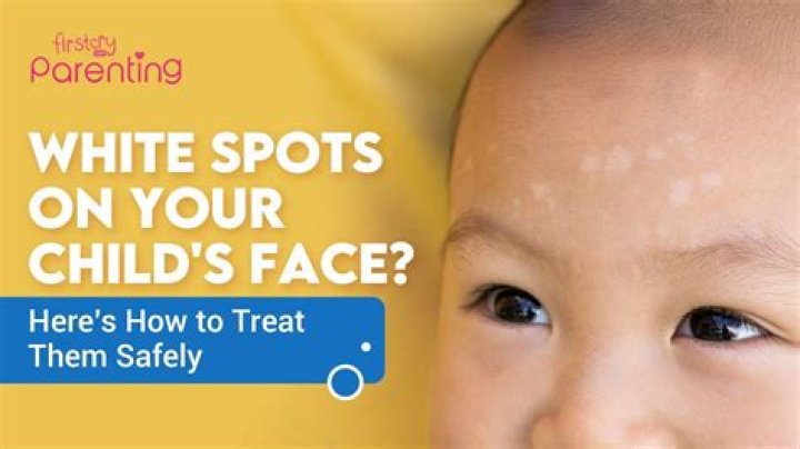White sun spots - How To Discuss
